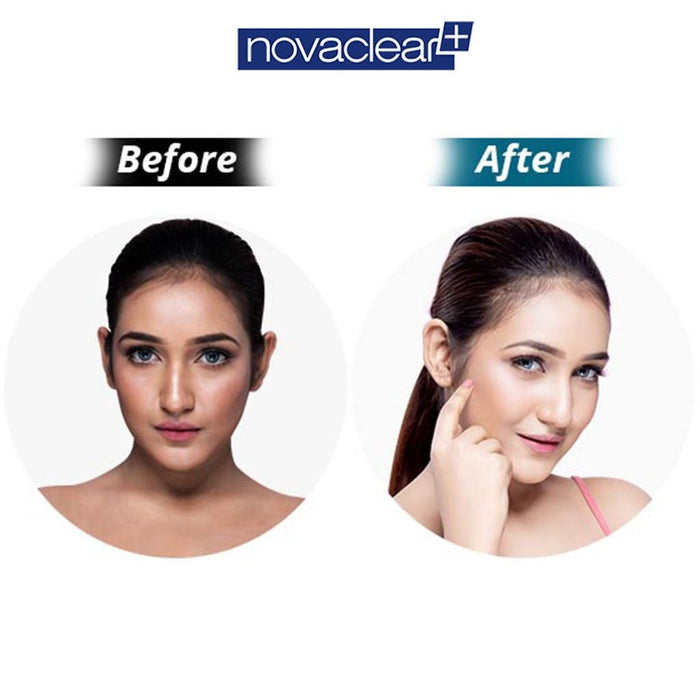 Novaclear Gluta White Plus Serum with Glutathione, Retinol & Vitamin C, 30ml - Makkah Pharmacy