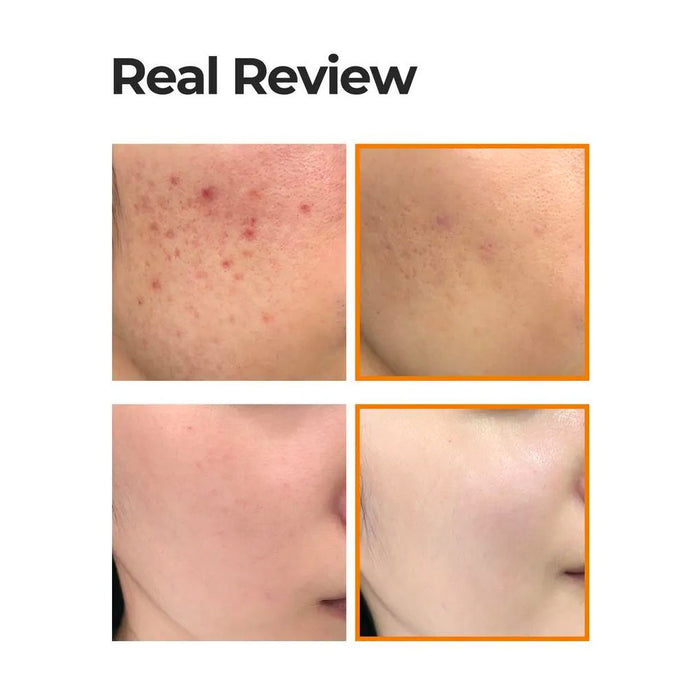 Some By Mi Propolis B5 Glow Barrier Calming Cream Review Nudie Glow Australia