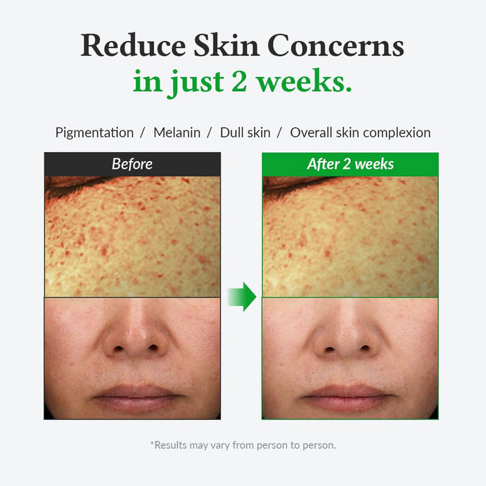 Dr. Althea Gentle Vitamin C Serum Nudie Glow Australia