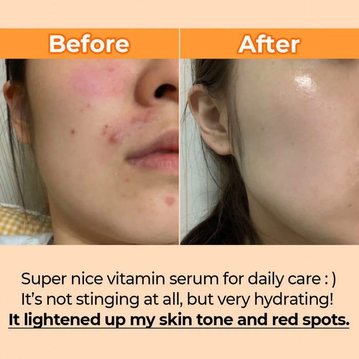 NUMBUZIN No.5 Goodbye Blemish Serum Nudie Glow Australia
